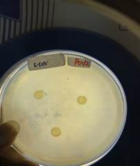 A petri dish with yellow round objects

Description automatically generated