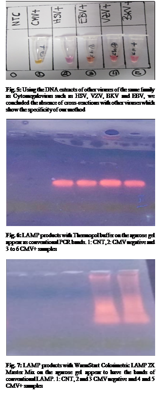 Text Box:  

Fig. 5: Using the DNA extracts of other viruses of the same family as Cytomegalovirus such as HSV, VZV, BKV and EBV, we concluded the absence of cross-reactions with other viruses which show the specificity of our method

 

Fig. 6: LAMP products with Thermopol buffer on the agarose gel appear as conventional PCR bands. 1: CNT, 2: CMV negative and 3 to 6 CMV+ samples

 

Fig. 7: LAMP products with WarmStart Colorimetric LAMP 2X Master Mix on the agarose gel appear to have the bands of conventional LAMP. 1: CNT, 2 and 3 CMV negative and 4 and 5 CMV+ samples

